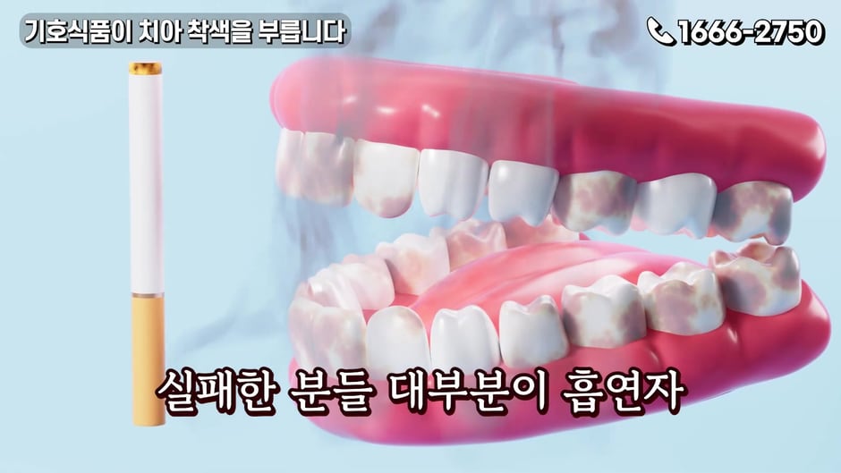 흡연으로 착색된 치아를 보여주는 그래픽 (영상 캡처)
